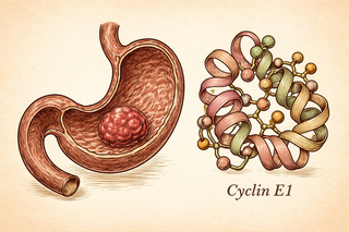 When an "Epithelial" Tumor Acts Like a Menace